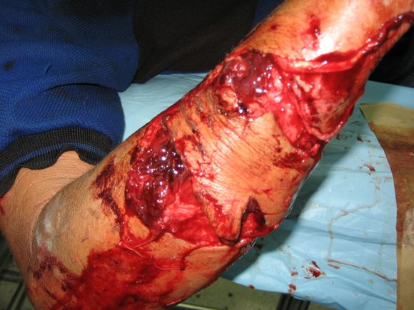 用骨头治服疯狗,用帽子治服狂人